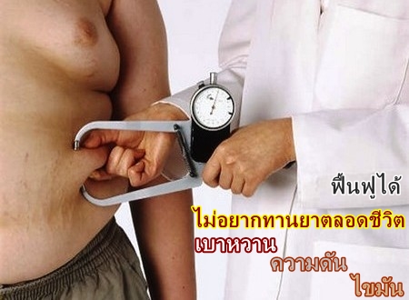 เบาหวานรักษาได้