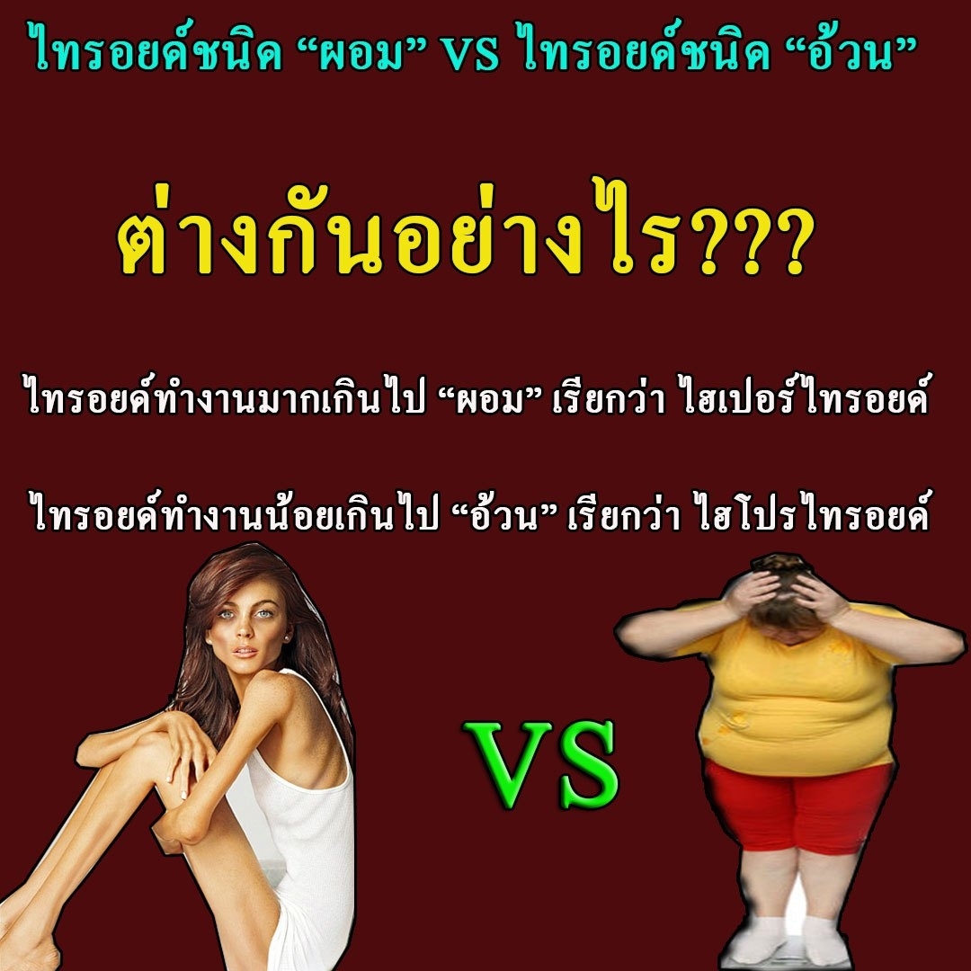 ไทรอยด์