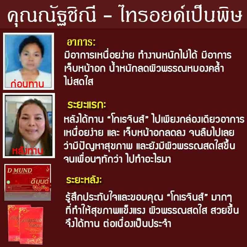 ไทรอยด์หายขาด